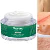 Rapid Scar Removal Cream Advanced Treatment for Old & New Scars from Cuts Stretch Marks C-Sections & Surgeries With Natural Herbal Extracts Formula (hypoallergenic)